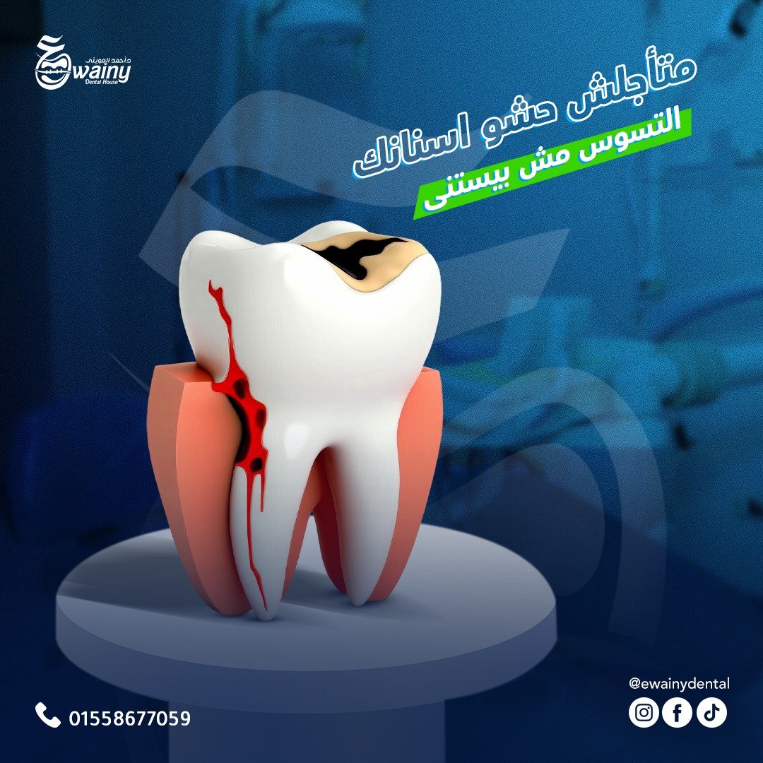 عيادة العويني لطب الأسنان - د. أحمد العويني — 7